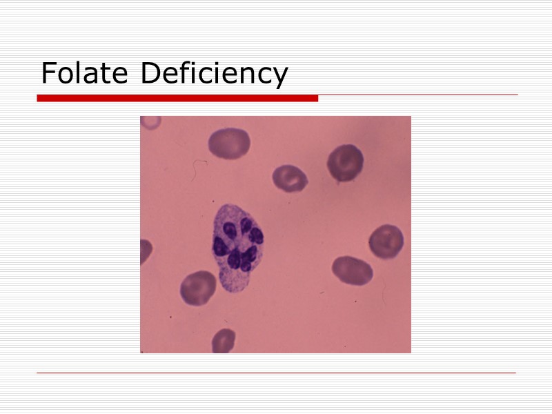 Folate Deficiency